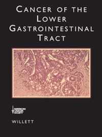 Cancer of the Lower Gastrointestinal Tract