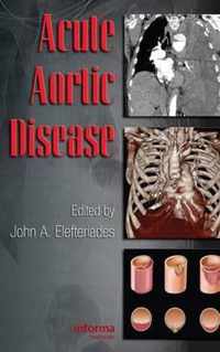 Acute Aortic Disease