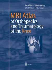 MRI Atlas of Orthopedics and Traumatology of the Knee