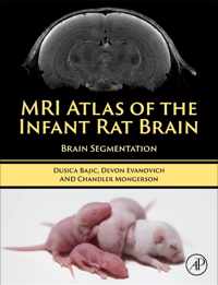 MRI Atlas of the Infant Rat Brain