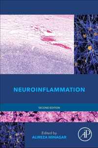 Neuroinflammation