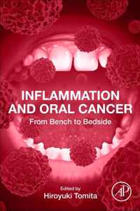 Inflammation and Oral Cancer