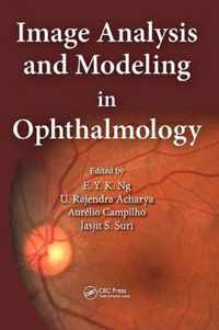 Image Analysis and Modeling in Ophthalmology