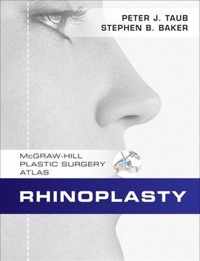 Rhinoplasty