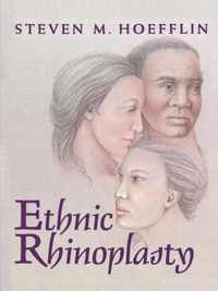 Ethnic Rhinoplasty