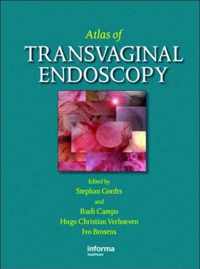 Atlas of Transvaginal Endoscopy