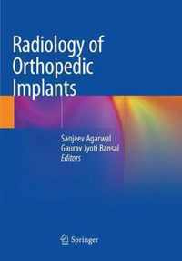 Radiology of Orthopedic Implants