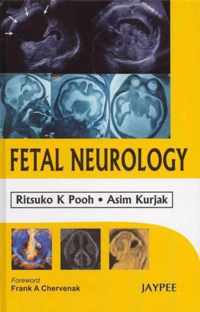 Fetal Neurology