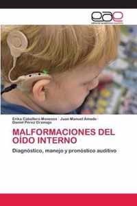 Malformaciones del Oido Interno