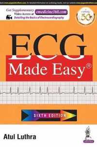 ECG Made Easy