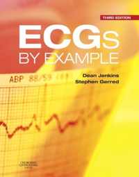 ECGs by Example