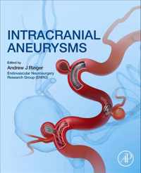 Intracranial Aneurysms