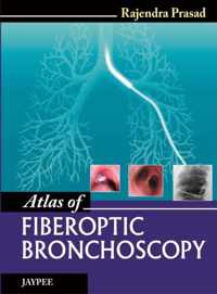 Atlas of Fiberoptic Bronchoscopy