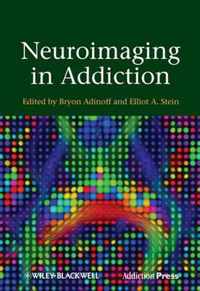 Neuroimaging in Addiction