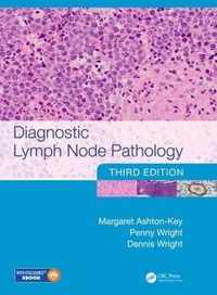 Diagnostic Lymph Node Pathology