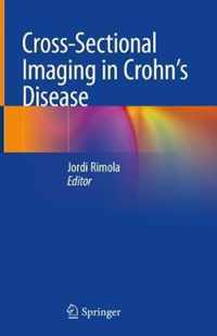 Cross Sectional Imaging in Crohn s Disease