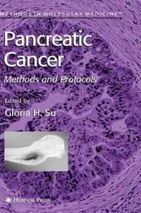 Pancreatic Cancer