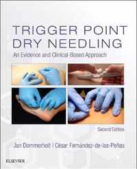 Trigger Point Dry Needling