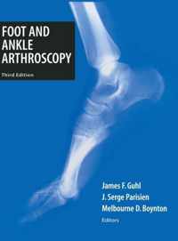 Foot and Ankle Arthroscopy