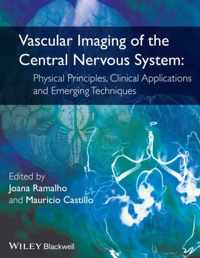 Vascular Imaging of the Central Nervous System