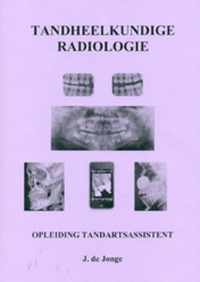 Tandheelkundige radiologie