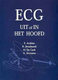 ECG uit of in het hoofd