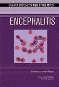 Encephalitis