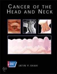 Cancer of the Head and Neck