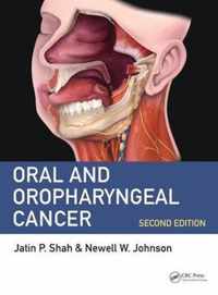 Oral and Oropharyngeal Cancer