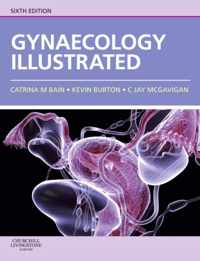 Gynaecology Illustrated