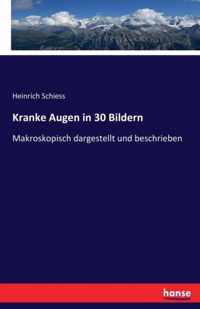 Kranke Augen in 30 Bildern