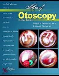 Atlas of Otoscopy