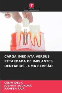 Carga Imediata Versus Retardada de Implantes Dentarios - Uma Revisao