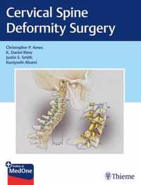 Cervical Spine Deformity Surgery