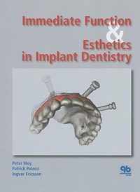 Immediate Function and Esthetic in Implant Dentistry