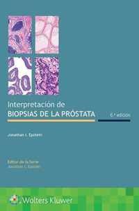 Interpretacion de biopsias de la prostata