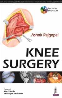 Knee Surgery