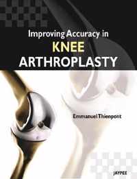 Improving Accuracy in Knee Arthroplasty