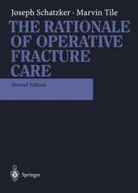 The Rationale of Operative Fracture Care