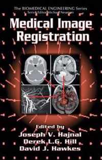 Medical Image Registration