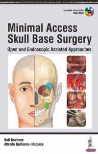 Minimal Access Skull Base Surgery