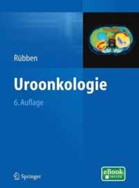 Uroonkologie