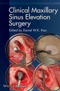 Clinical Maxillary Sinus Elevation Surgery