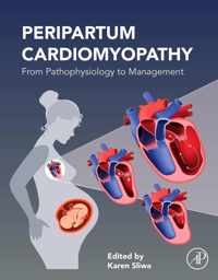 Peripartum Cardiomyopathy