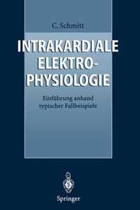 Intrakardiale Elektrophysiologie