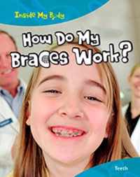 How do my Braces Work?