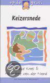 Keizersnede