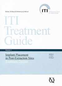 ITI Treatment Guide