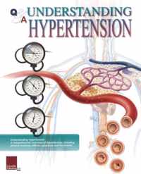 Understanding Hypertension Flip Chart