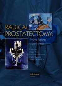 Radical Prostatectomy